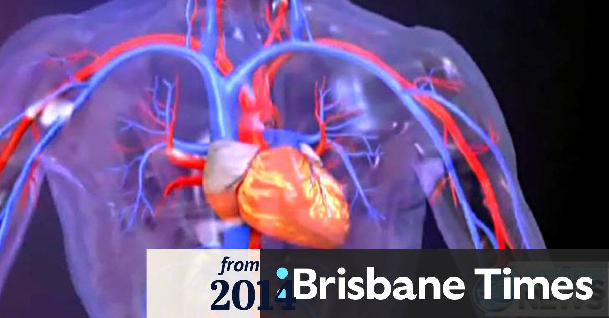 Video Exercise can cause heart problems